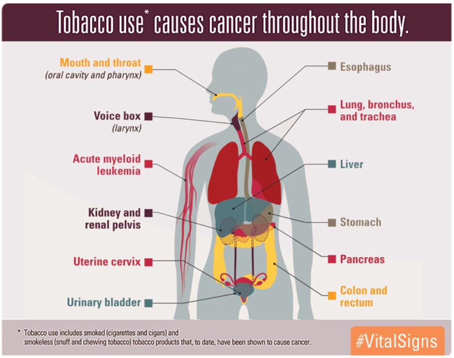 CDC Tobacco use causes cancer throughout the body